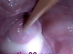 Insertion Semen Cum in Cervix Wide Opening Up Cunt Speculum