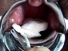 MiracleSatchin Asian TAMPON insertion my Cervix 