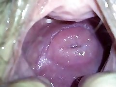 my japanese girlfend's adorable cervix in gigantic hole