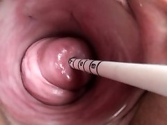 Uterus play with Asian sounding injection