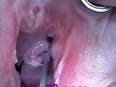 Cum Insertion with Syringe in Cervix Uterus after Boning