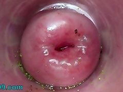 Extreme female inserting nettles into cervix and rod flowers