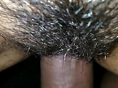 Hairy close up Hairy close up