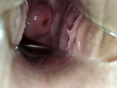At the GYNECOLOGIST!! A speculum in the chick's pussy!!