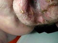 Very old granny pissing Very old granny pissing