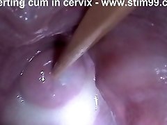 Insertion Semen Cum in Cervix Wide Stretching Poon Speculum