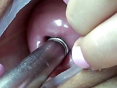Girly-girl piss inside the Uterus of other with tube in PeeHole