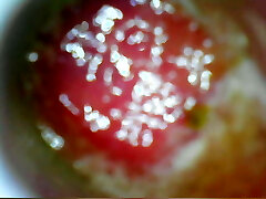 USB endoscope 80 cm deep anal insertion