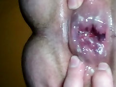 Anal gape Sonde