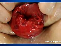 Sindy Rose Self Anal Fisting & full vedios ses Asshole Prolapse