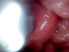 First Time: an Endoscope Reveals the G-spot up Close - Without Mounting!