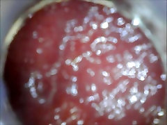 anal endoscope first time sex boldly play from inside anal endoscope first time sex boldly play from inside