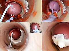 Cumfeti Dripping Creampie Compilation- Endoscopy View