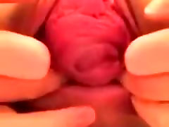 योनि और गुदा आगे को बढ़ाव पर वेब कैमरा -