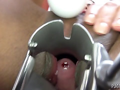 Gyno,