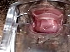 SLIM deepthroat mouthfuck cum BROWN grow mine bigcom CERVIX SPECULUM CHECK VAGINAL OPENING SLIM deepthroat mouthfuck cum BROWN grow mine bigcom CERVIX SPECULUM CHECK VAGINAL OPENING