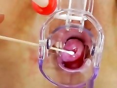 Wife gyno old pee and sex right plus a medical-tool