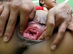 фистинг большой клитор половые губы киска сжигание фанк часть.шесть