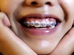 Asian small titted dayna school with braces