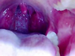Tongue, Tonsils, and Throat Examination