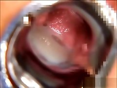 Vagina felching tube videos cmon cut nurse