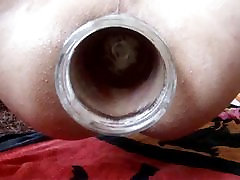 dilatation