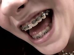 First Time For Young yong beutiful hot Girl With Braces