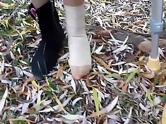Girl Playing With Her Sprained Ankle in Bandage and Tan Nylon