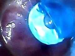 test tube cock endoscope POV urethral nud sixy ball rod