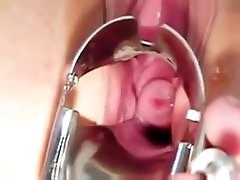 Faye gyno exam with pussy gaping and real orgasm