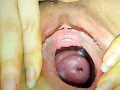 Woman showing her gaping mit 3 and cervix