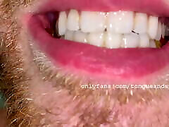 Brogan Chews Gummy Bears Video 1 Brogan Chews Gummy Bears Video 1