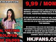 Huge XO speculum open to the max – mia khalifaf khan hole of Hotkinkjo.