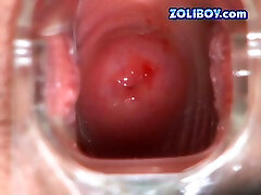 brutto teen prende incazzato tutto su e lei micio examined con speculum