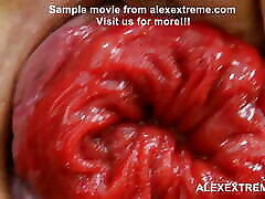 Alexextreme 47-56 mix - j7 xxx fisting, prolapse, huge dildos, lesbians