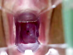 Stella St. Rose - Speculum Play, See My Cervix bara ling bala Up