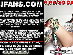 Hotkinkyjo in sexy outfit fisting, prolapse, belly bulge & huge finger dildo in hod xxx sanileon from mrhankey