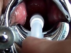 MiracleSatchin Asian TAMPON injection my Cervix