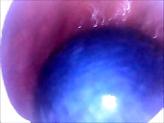My ass swallows 2 chinese balls and 2 pool nuts
