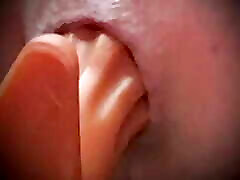Anal solo