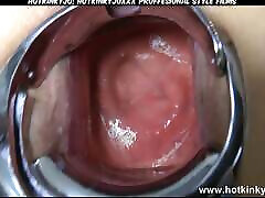 creampie best beautiful Plastic Dress Xo Speculum Deep Self Fuck