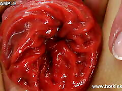 Big Black Plug in My Loose Ass & Anal Prolapse by Hotkinkyjo