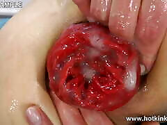 Big Blue Dong Total Anal Destruction & Prolapse by Hotkinkyjo