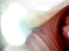 A detailed examination of Lopuza93 Vagina area using an endoscope camera.