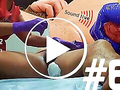 62 Male Waxing