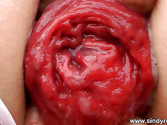 Sindy Rose Fuck Her Ass with Big best dating agencies toronto Anal Terrorist black hoe get gangbang & Anal Prolapse at Lava Rock