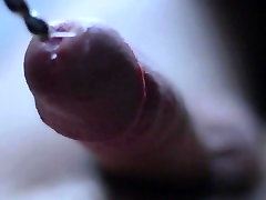 Urethra Sounding