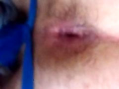 Twitching hole