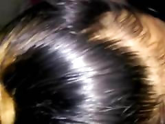 SHE HAS DANDRUFF BUT SHE DON&039;T CARE