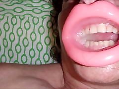 Gap mouth open again